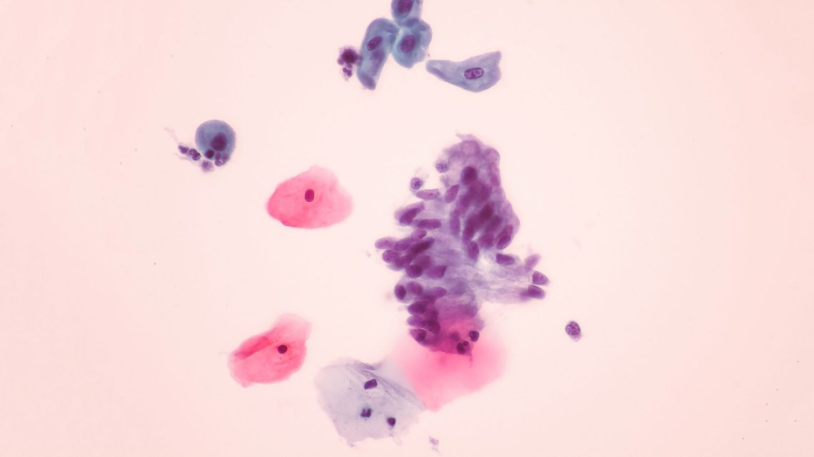 Vista microscópica de células epiteliais glandulares