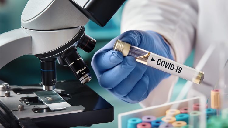Concurso “Research 4 COVID-19” – Apoio especial da FCT para resposta à pandemia