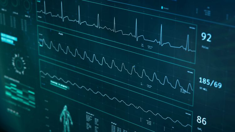 O futuro da eletrocardiografia pode ser “invisível” e está a ser feito com o cunho do Técnico